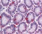 SAR1A / SAR1 Antibody (Internal)